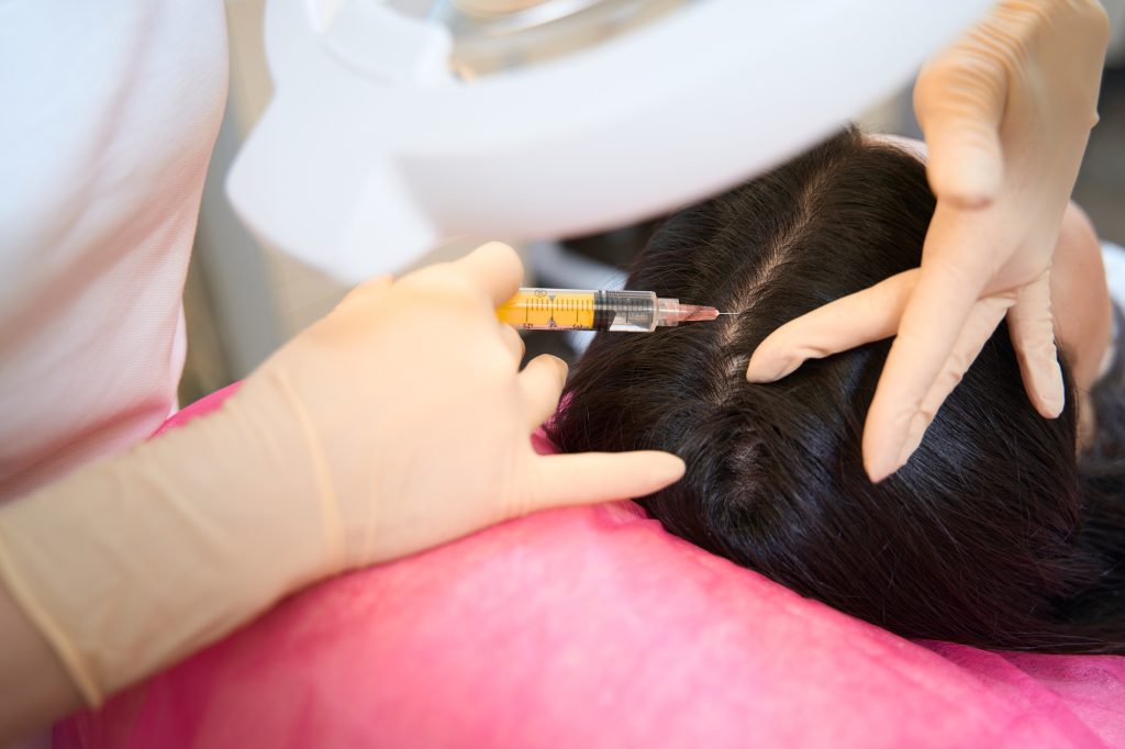Doctor giving the patient injections into the scalp to improve hair growth